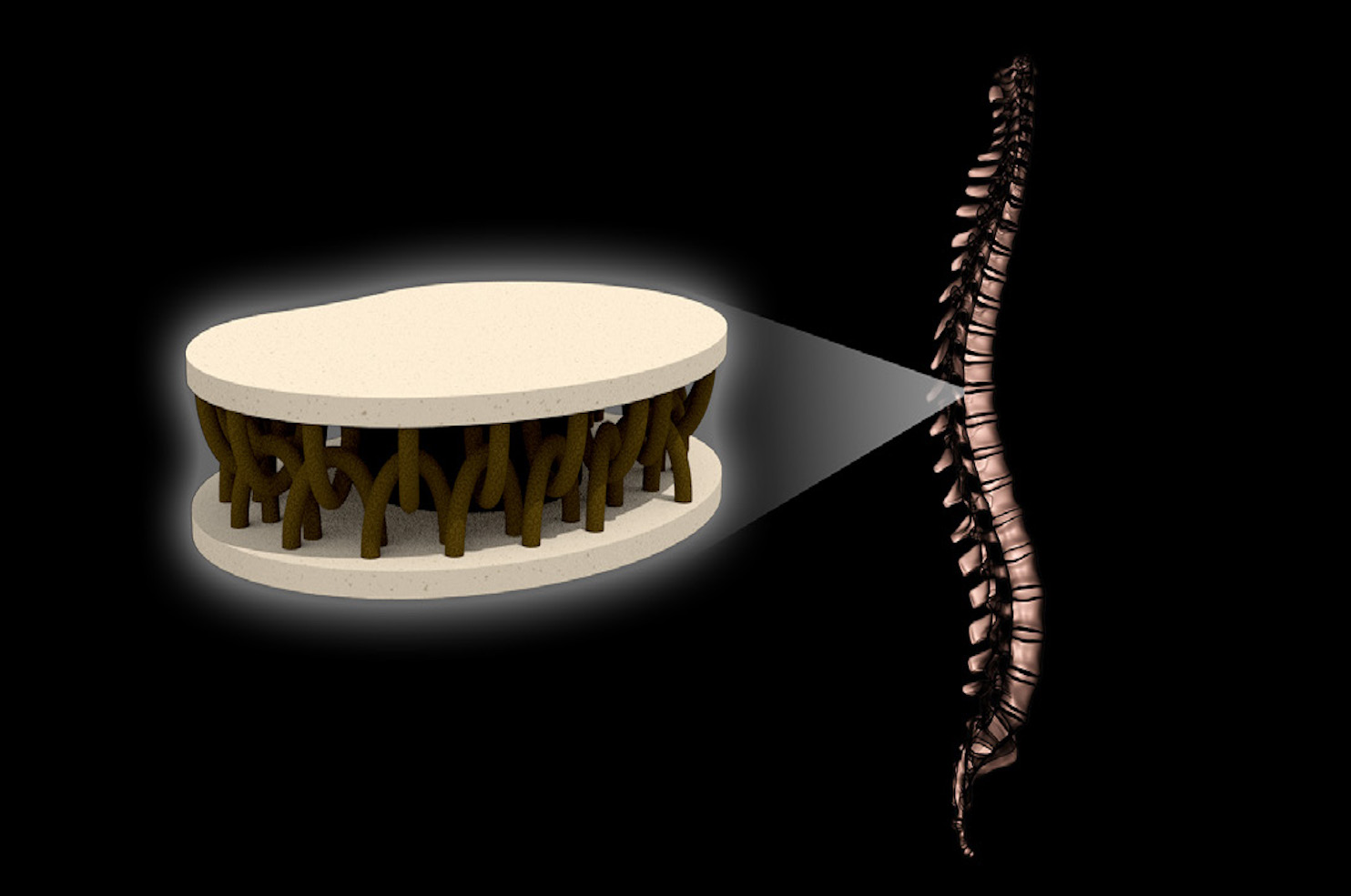 Spinal disk